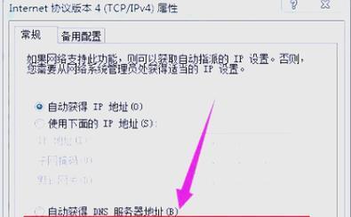 dota2视距调整方法是什么？